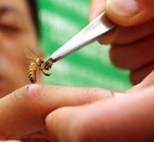 طبيب بيطري في اليمن يعالج المرضى عن طريق لسعات النحل  من داخل دكانه الصغير  .. ( اليكم التفاصيل )