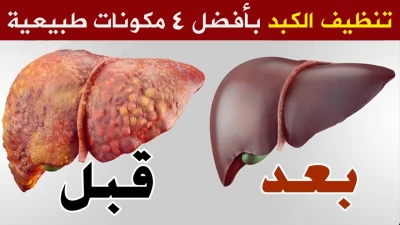 اكتشف الحل الطبيعي الجديد لتفتيت حصوات الكلى وتنقية جسمك بكل سهولة وفاعلية