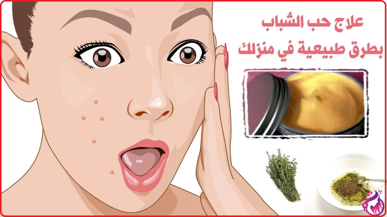 علاج حب الشباب في المنزل