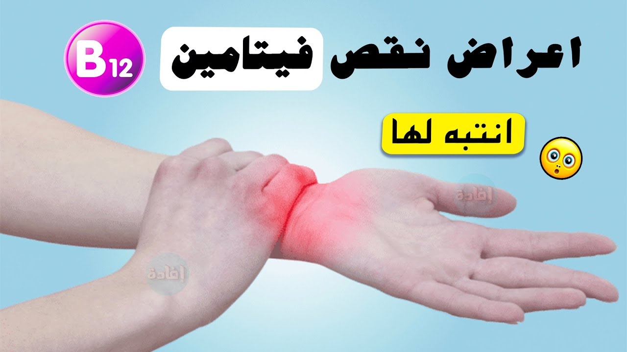 علامة نقص فيتامين B12