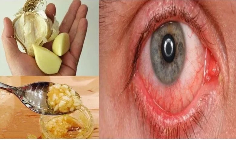  معجزة تحسين النظر في اقل من شهر.. حبة واحدة فقط للقضاء على ضعف النظر نهائيا شاهد
