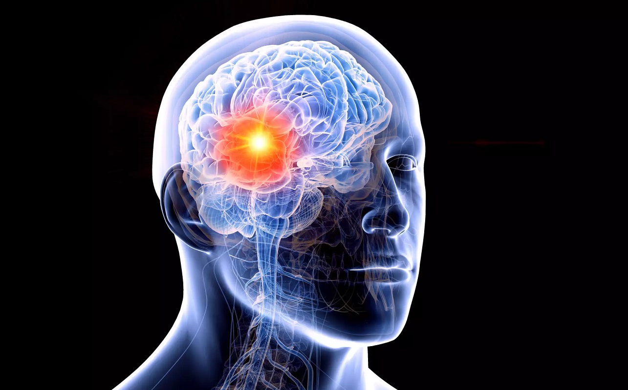 الدماغ