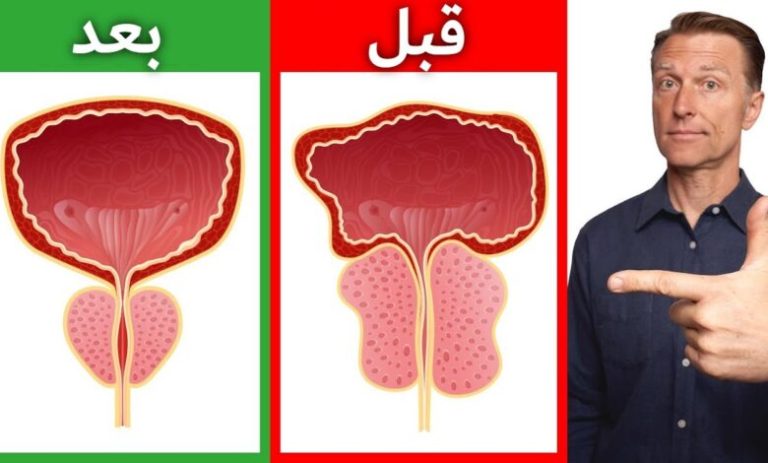 تعرف على أهم عنصر غذائي لتصغير البروستاتا .. يخلصك الى الابد من تكرار التبول وتضخم البروستاتا