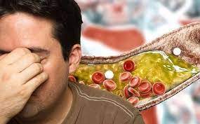 دكتور سعودي يكشف عن نبتة شهيرة تخفض الكوليسترول في الدم وتعالج السعال والإمساك المزمن !