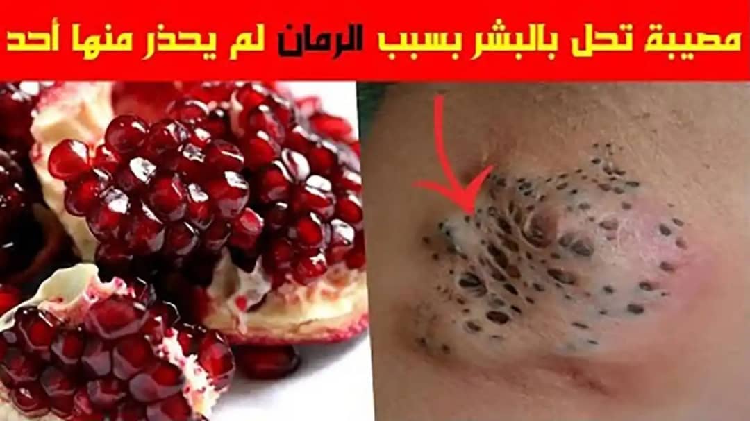 الرمان
