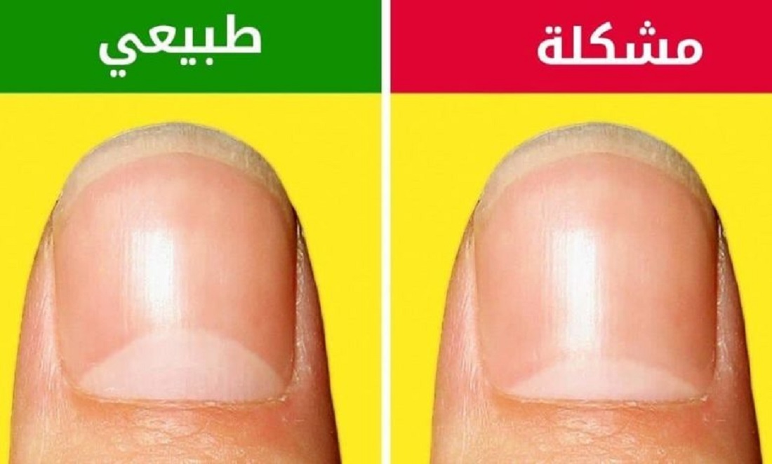 الأظافر