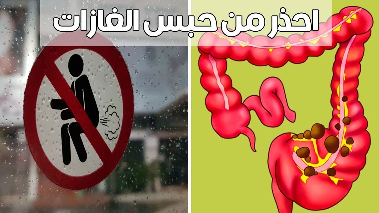 أضرار حبس الغازات