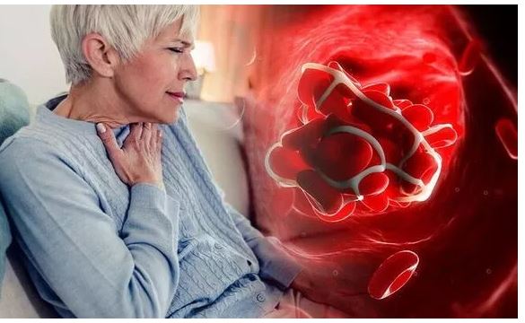 احذر قبل فوات الأوان..الألم في أربع مناطق بالجسم مؤشر على وجود جلطة دموية