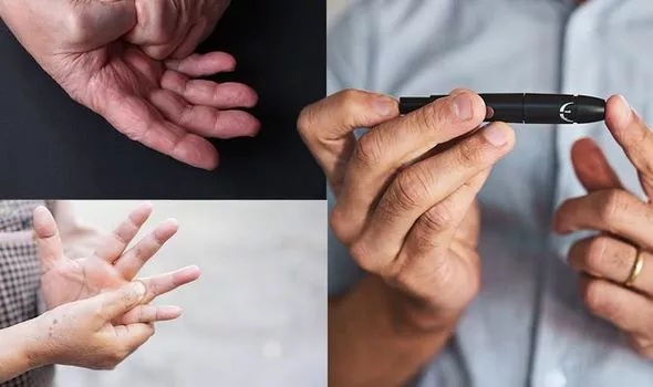 علامات ارتفاع السكر