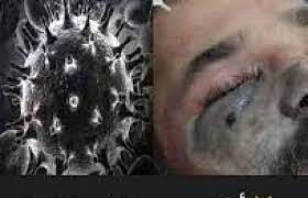 تخلص منها فورا.. 7 أشياء موجودة في الثلاجة والغرف والبلكونة تصيبك بالقاتل الصامت