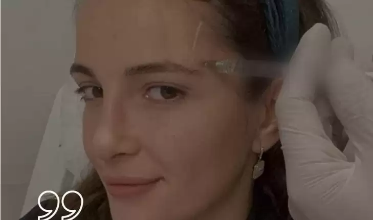 كبرت هذه المنطقة الحساسة .. شام الذهبي تخضع لعملية تجميل وتصدم والدتها اصالة بشكلها الجديد !! صور