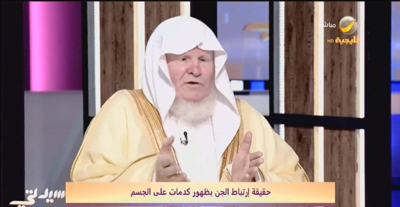 هل وجود كدمات في جسم الشخص بعد الاستيقاظ دليل على أن لامسه جن أثناء النوم؟ .. راقي شرعي يُجيب!