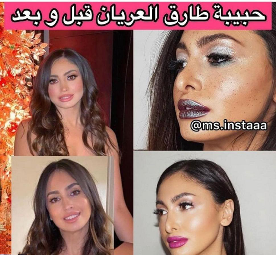 نيكول سعفان قبل وبعد عملية التجميل